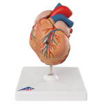 Classic Heart Model with LVH