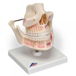 Adult Dentures Model