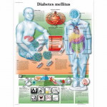 Chart "Diabetes Mellitus"_noscript