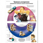 Chart "Acceleration Injury to the Cervical ..." Russian_noscript