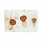 Fungi and Lichen Slide_noscript