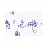 Pathogenic Bacteria Spanish Slide