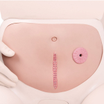 Abdominal Wall with Staple Suture_noscript