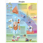 Chart "Alergias", Portuguese, Paper_noscript