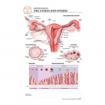 Uterus And Ovaries "Post It" Chart
