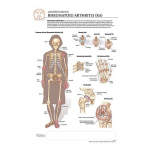 Rheumatoid Arthritis "Post It" Chart_noscript