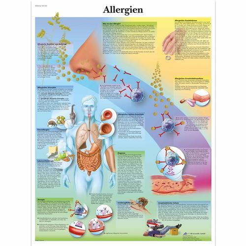 3b Scientific 1001434, Chart "allergien"