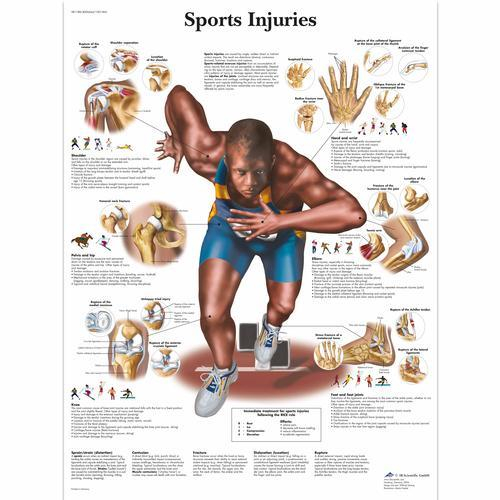 3b Scientific 1001494, Chart "sports Injuries"