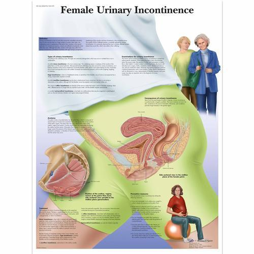 3b Scientific 1001570, Chart "female Urinary Incontinence"