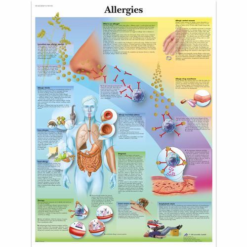 3b Scientific 1001596, Chart "allergies"