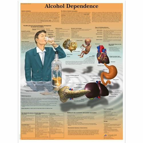 3b Scientific 1001620, Chart "alcohol Dependence"