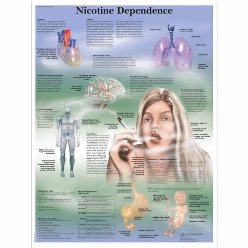 3b Scientific 1001622, Chart "nicotine Dependence"