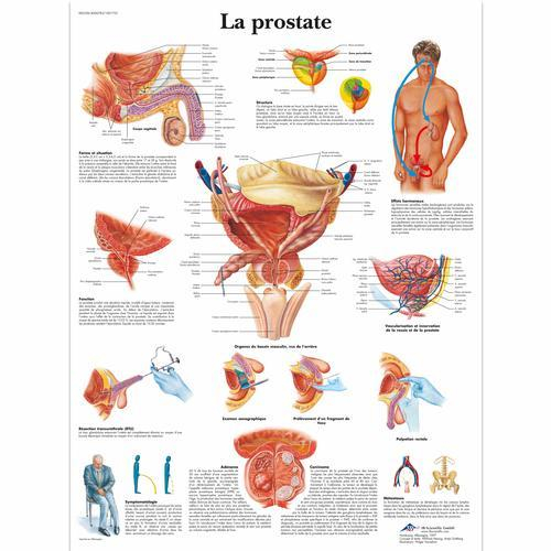 3b Scientific 1001733, Chart "la Prostate"