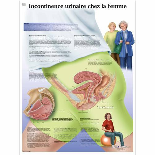 3b Scientific 1001737, Chart "incontinence Urinaire Femme"
