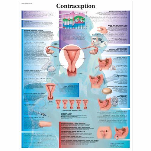 3b Scientific 1001747, Chart "contraception"