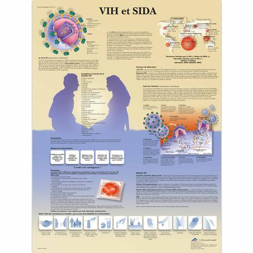 3b Scientific 1001778, Chart "hiv Et Sida"