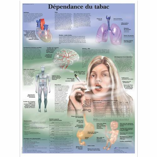 3b Scientific 1001791, Chart "dependance Du Tabac"