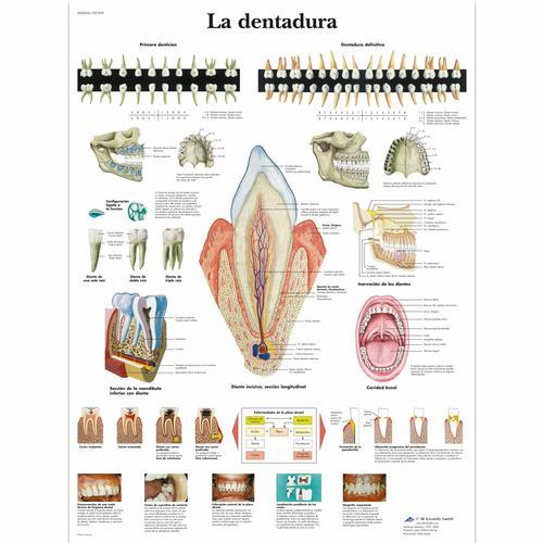 3b Scientific 1001839, Chart "la Dentadura"