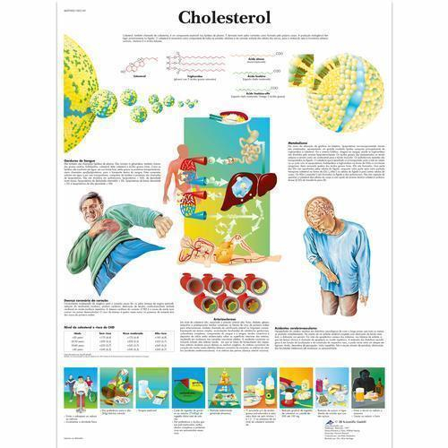 3b Scientific 1002169, Chart "cholesterol" Portuguese