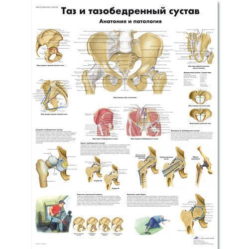 3b Scientific 1002228, Chart "pelvis And Hip" Russian