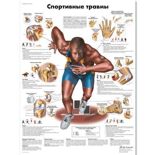 3b Scientific 1002236, Chart "sports Injuries" Russian