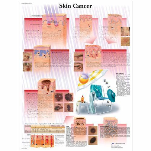 3b Scientific 4006674, Chart "skin Cancer", Paper