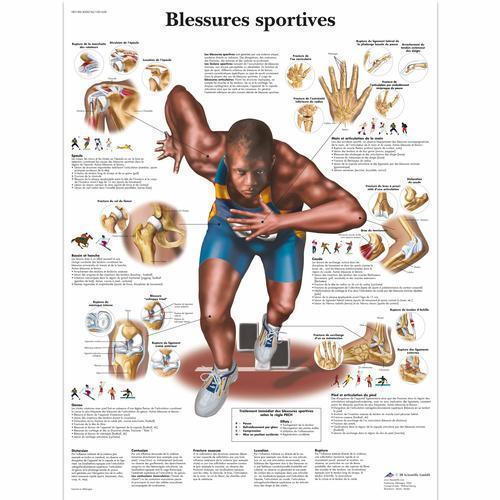 3b Scientific 4006746, Chart "blessures Sportives", French, Paper