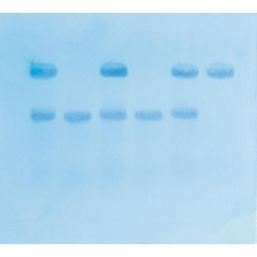 Edvotek 315, In Search Of The Sickle Cell Gene By Southern Blot