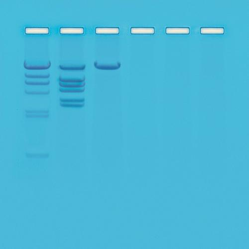 Edvotek Ap09, Biotechnology - Restriction Enzyme Analysis Of Dna