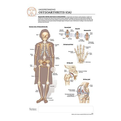 Fischer Technical Company Bs312, Osteoarthritis "post It" Chart